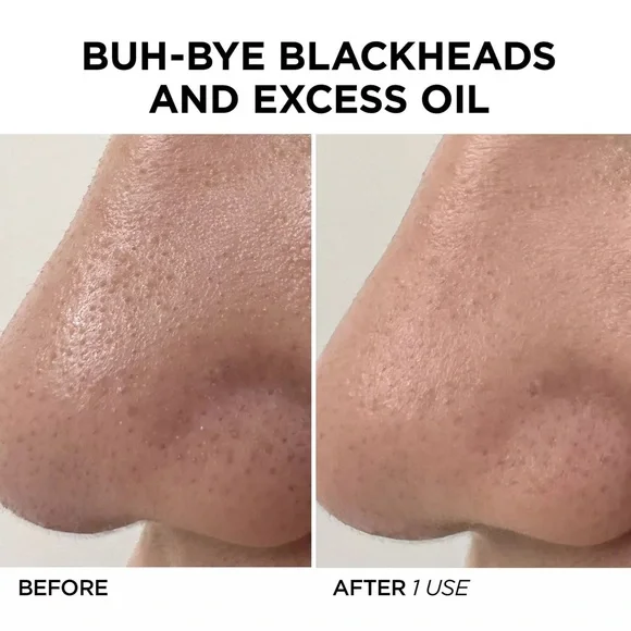BeautyBio White Pore Cleansing Tool